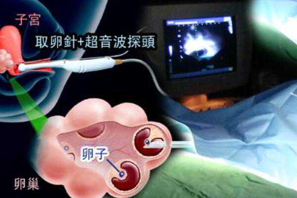 武汉借卵助孕要多少钱 武汉大学人民医院做试管能选男孩吗? ‘怀孕b超图形看
